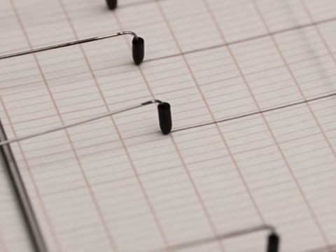 Beat 27: Chart sweep