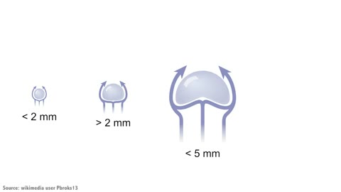 Beat 2: Drops and sizes