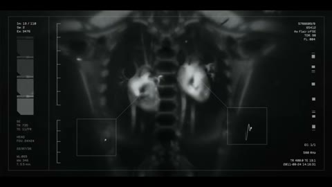 Beat 3: Body scan to powertrain