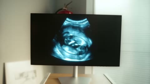 Beat 1: Ultrasound