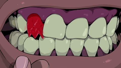 Beat 16: Tooth swap