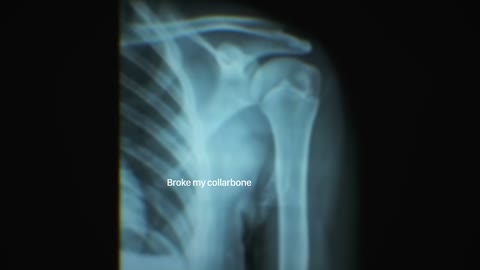 Beat 8: X-ray